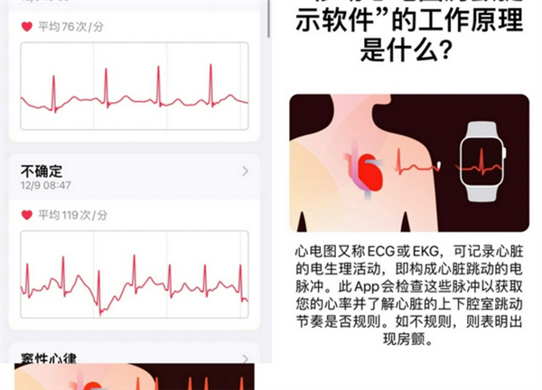 iOS 15.2發布后:國行Apple Watch用戶期待ECG功能上線快升級 iOS 15.2發布后:國行Apple Watch用戶期待ECG功能上線快升級